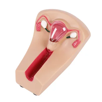 Модел на женското внутриматочного контрацептива, Марка тренажор за вътрематочна спирала